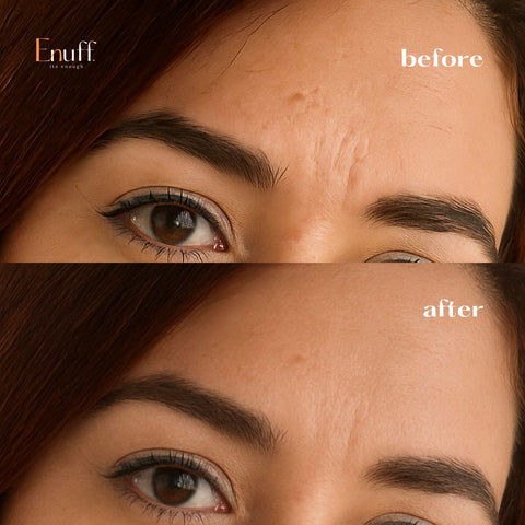 Liftique Drops : Botox at Home